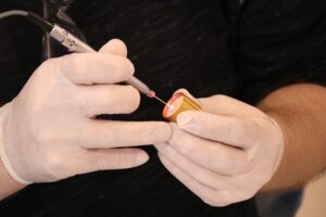 ¿Cómo funciona un láser médico?