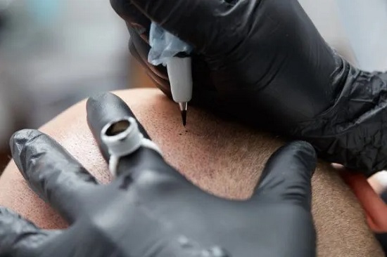 Equipo de micropigmentacion capilar